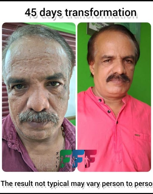 RELIEF  WEIGHT MANAGEMENT CENTRE kAKKODI