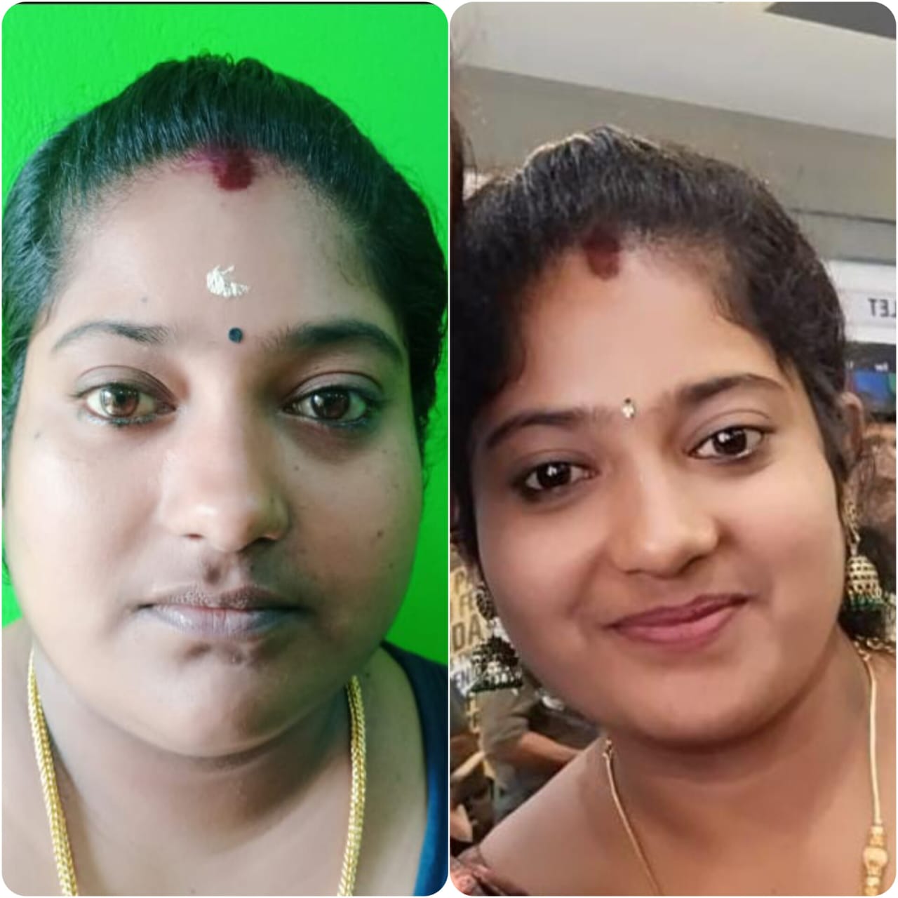 RELIEF  WEIGHT MANAGEMENT CENTRE kAKKODI